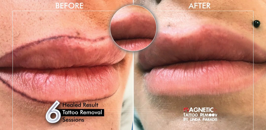 Aquarelle Lip Blush - The latest technique in Permanent Lip Makeup
