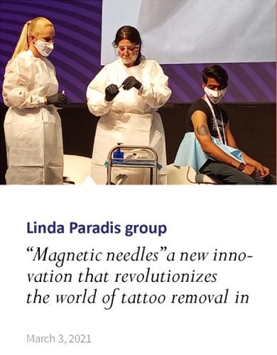 Non-Invasive Magnetic Tattoo Removal Technique by Linda Paradis