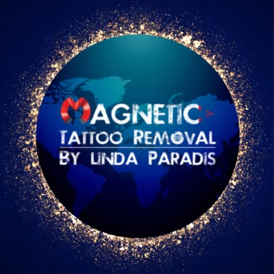 Non-Invasive-Magnetic-Tattoo-Removal-Technique-by-Linda-Paradis