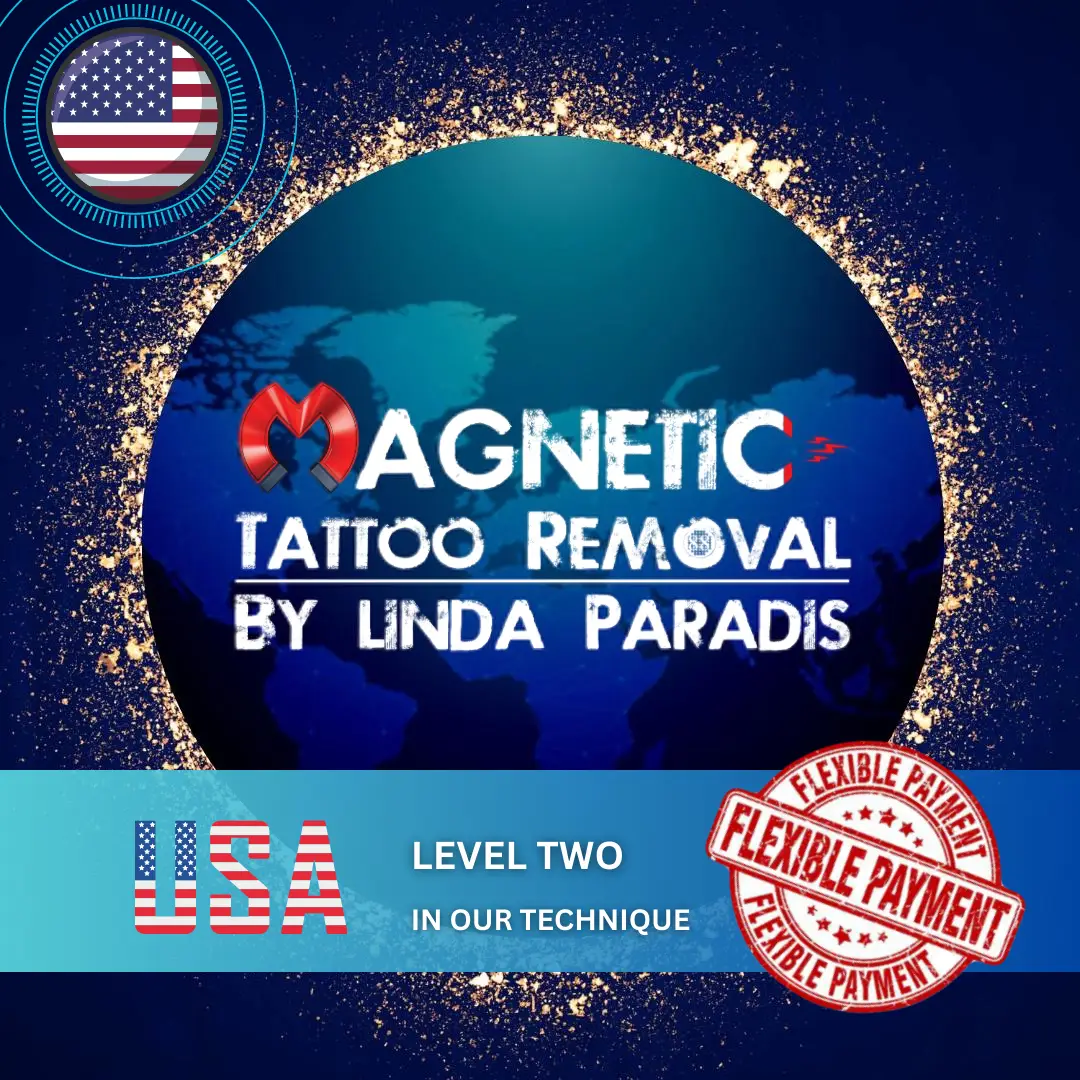Laser Tattoo Removal vs Other Removal Methods