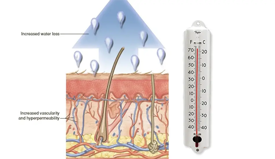 Thermal action