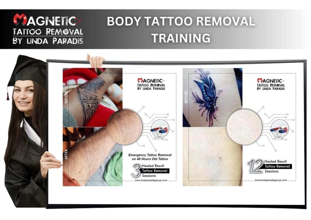 Magnetic-Tattoo-Removal-for-Body-tattoo-Removal-training-course