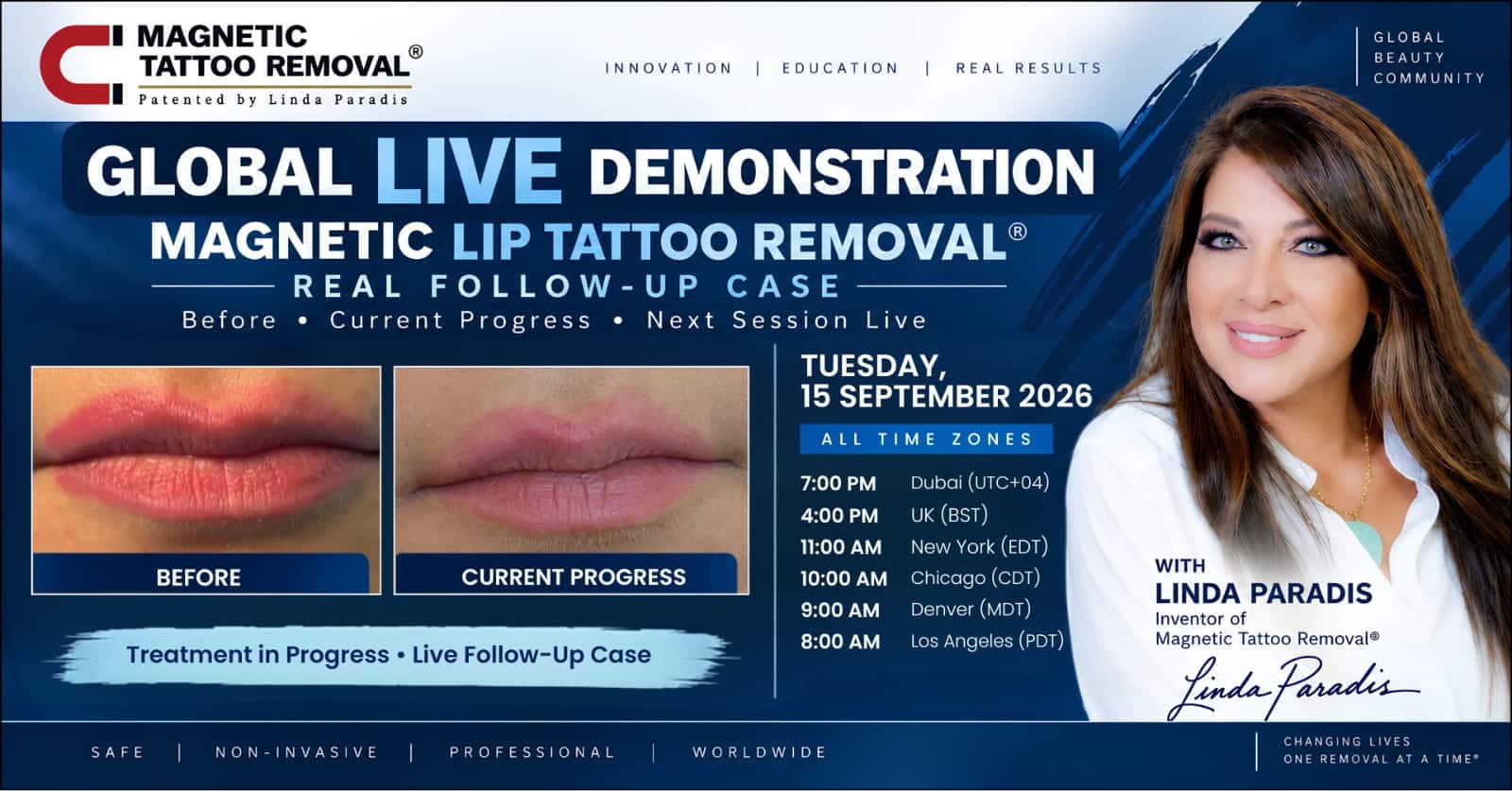 Global Live Demo: Magnetic Lip Tattoo Removal® Protocol Update