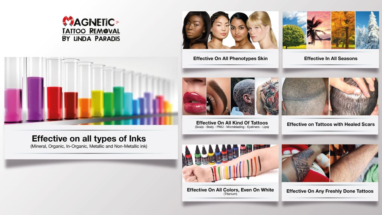 Magnetic Tattoo Removal Works on