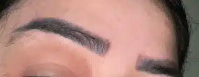 Eyebrows four weeks after the first MTR session, fully healed