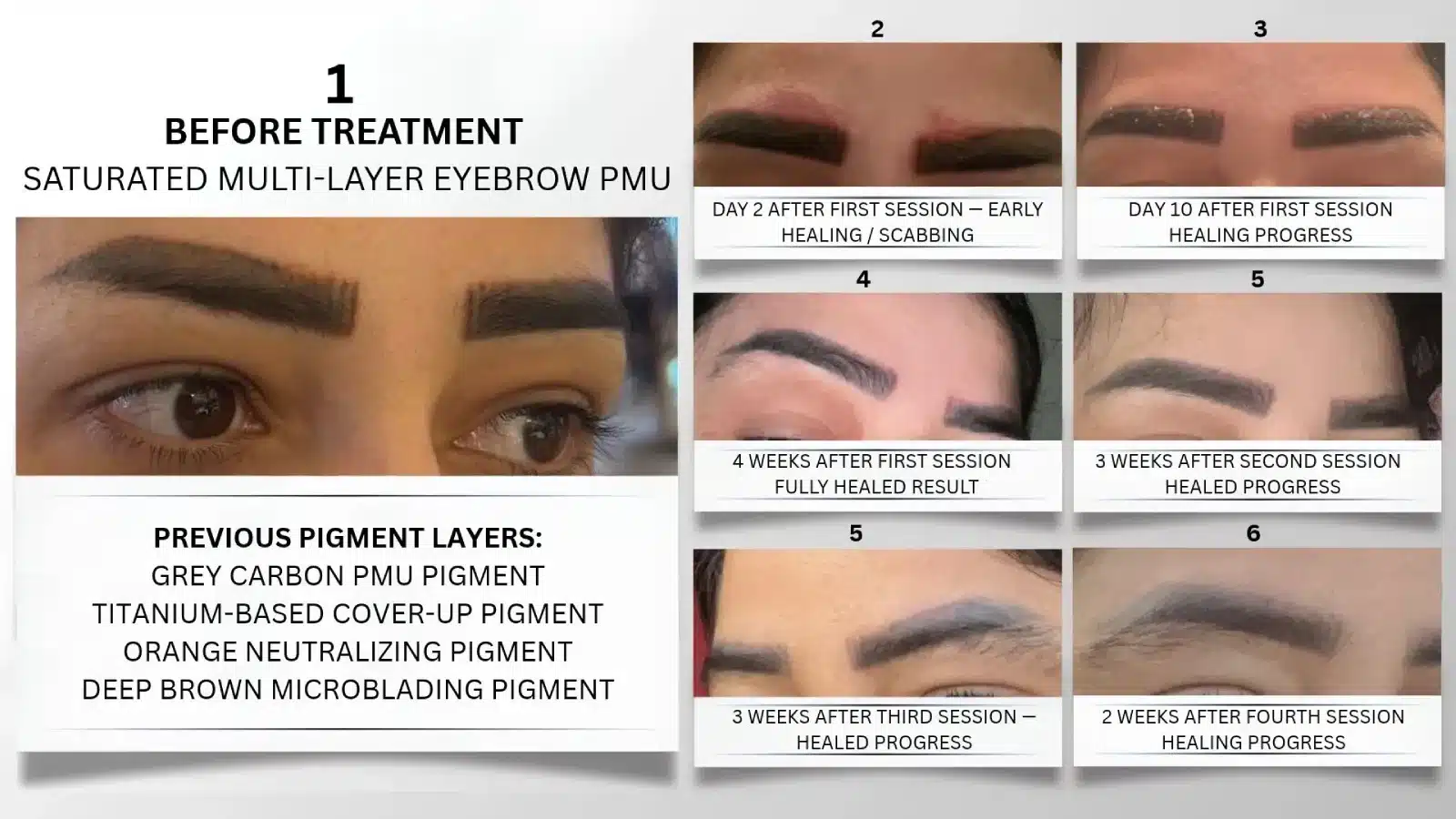 Microblading removal guide: eyebrow pigment healing stages before and after